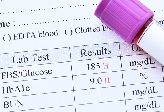 A1C Test US MED Article